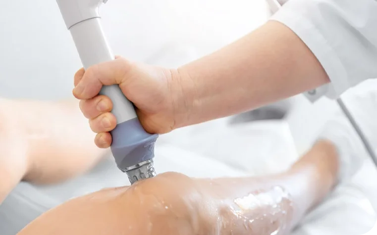 Cryotherapy treatment in London by FCM