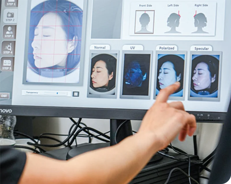 Skin-Rejuvenation-Programmes Mesotherapy
