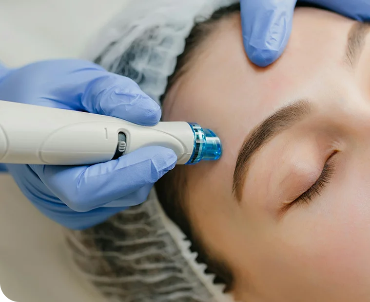 Special-Treatments Mesotherapy