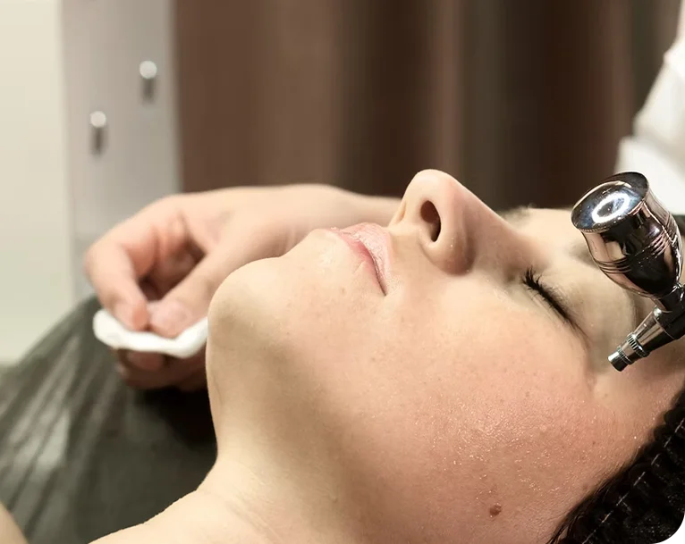 eye-transformation Mesotherapy