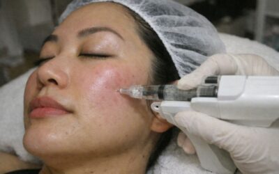 How Much Does Korean Mesotherapy Cost in London?