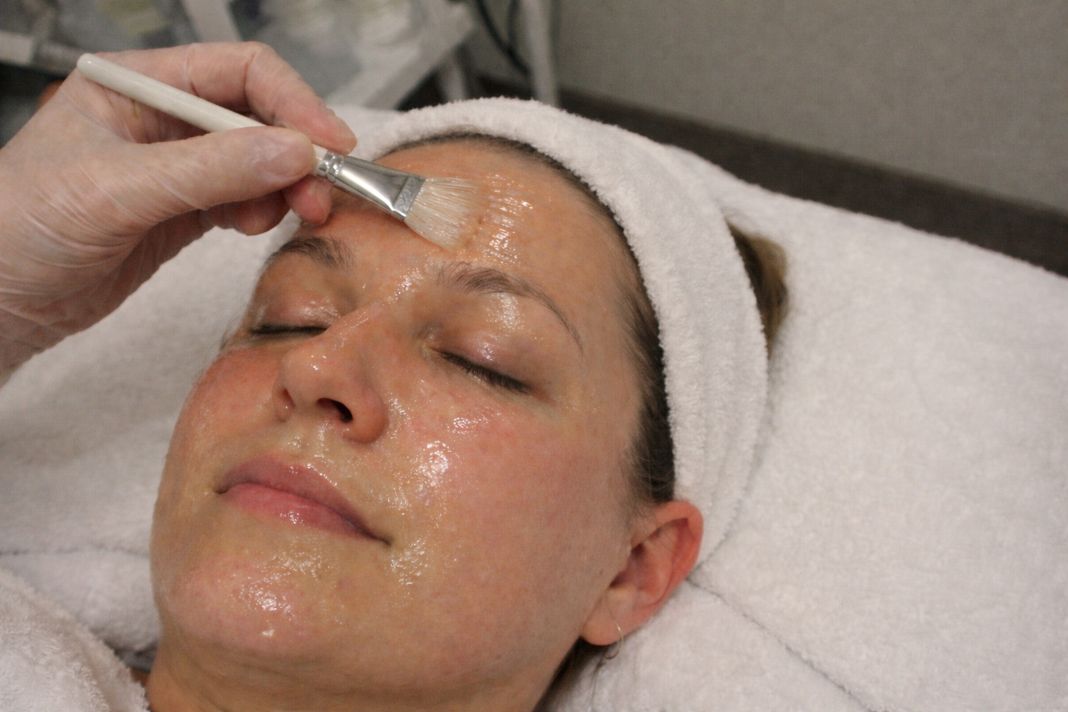 Where to Get Korean Glass Skin Treatments in London