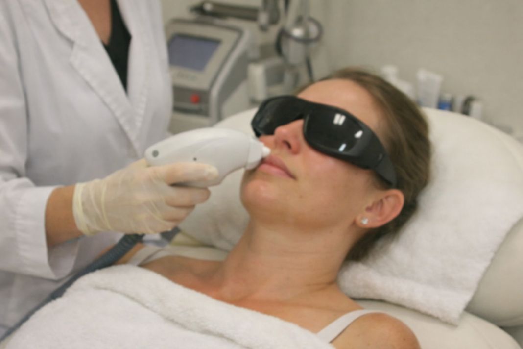 AI image of a cosmetic or dermatology procedure