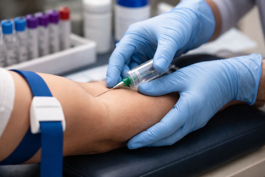 AI image of drawing blood in a clinical setting