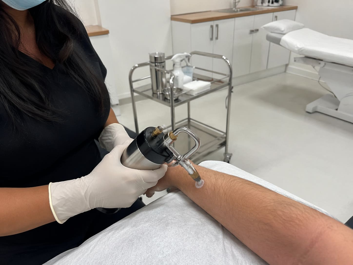 Cryotherapy freezing lesion treatment – Illustrative Image