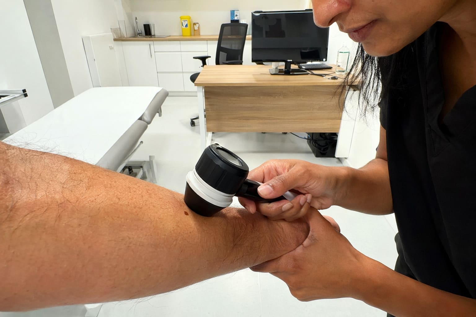 Dermatoscope Mole Review - Illustrative Image